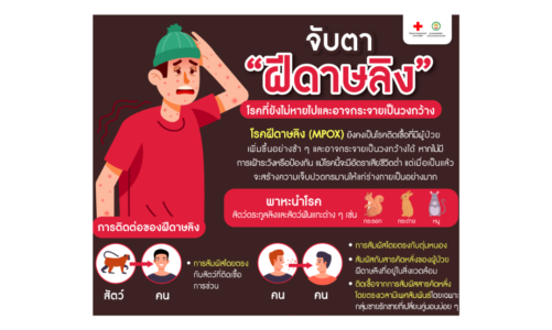 จับตา “ฝีดาษลิง” …โรคที่ยังไม่หายไปและอาจกระจายเป็นวงกว้าง
